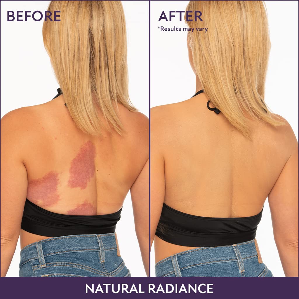 WestGlow™ Body Concealer