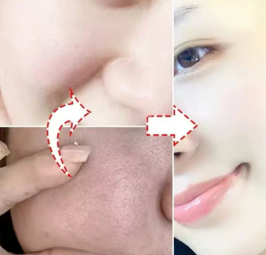 DermaLift™ Collagen Mask