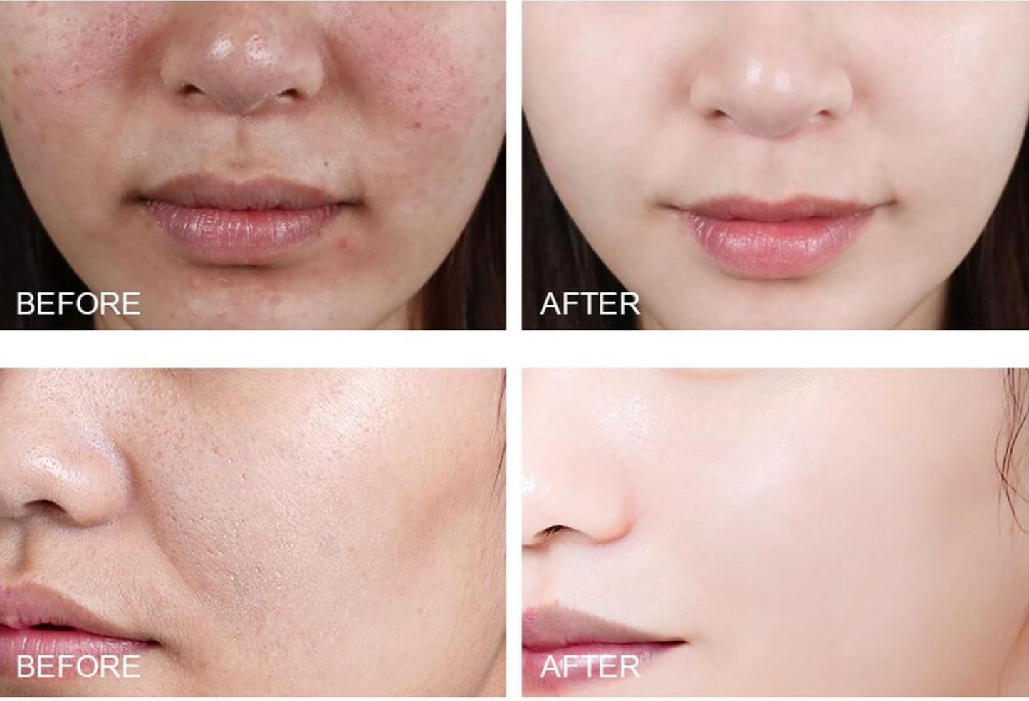 AuraGlow™ Exfoliating Gel